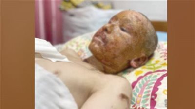 مصر تواصل ضغوطها برفض اجتياح رفح وتطالب بوقف استهداف المساعدات