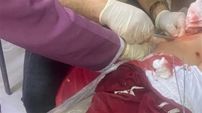 إنقاذ حياة طفل بمستشفى فاقوس المركزي يعاني من نزيف حاد