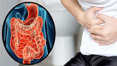 منها القولون العصبي.. 5 أمراض مرتبطة بالإمساك المزمن