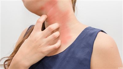 النظام الغذائي الخالي من الغلوتين يساعد على التخلص من الاعتلال العصبي