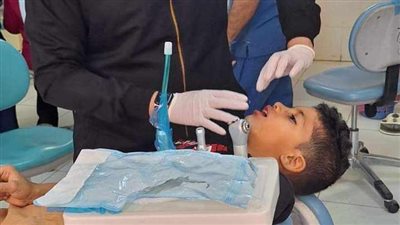 طب أسنان المنيا تُقدم 400  خدمة علاجية للأطفال 