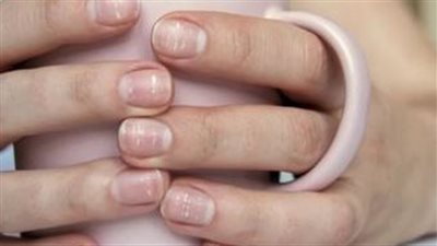 شكلان غير عاديين لأظافرك يشيران إلى مستويات منخفضة من فيتامين ب 12