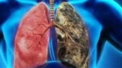 أبرز المشروبات الطبيعية لتنظيف الرئتين من السموم