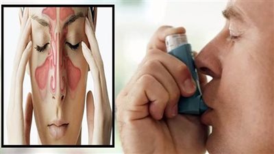 النساء أكثر عرضة لنوبات الربو مقارنة بالرجال