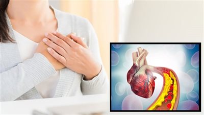 الكشف عن أفضل 5 مجموعات غذائية لخفض الكوليسترول 