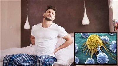 نوعان من آلام الجسم المستمرة مرتبطة بالسرطان.. أبرزها الظهر