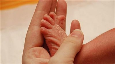 نصائح لتجنب إصابة طفلك بالجفاف في فالصيف