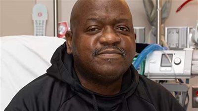 بعد شهرين.. صاحب زراعة كلية الخنزير يفجع الأطباء بوفاته