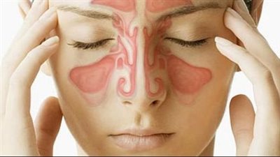 نصائح هامة لمرضى التهاب الجيوب الأنفية.. التقلبات الجوية خطر