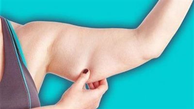 دهون الذراع العنيدة تكشف الكسور وهشاشة العظام