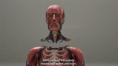 أول جراحة لزراعة المخ في جسد شخص ميت دماغيًا.. تفاصيل مثيرة ومخاطر تصل للموت (فيديو)   