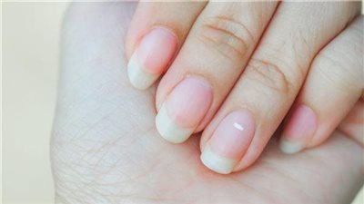 أسباب ظهور البقع البيضاء على الأظافر
