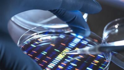 اكتشاف شكل جيني جديد لمرض ألزهايمر يظهر في سن مبكرة