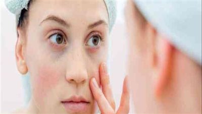 علاجات منزلية ونصائح لتقليل تورم الوجه