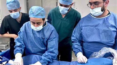 استخدام الصمغ الطبي في علاج الدوالي بمجمع الإسماعيلية الطبي 