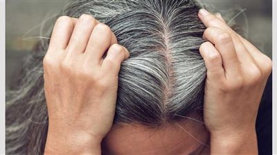 هل الإجهاد يسرع من ظهور الشعر الأبيض؟ .. طبيبة تكشف الحقيقة