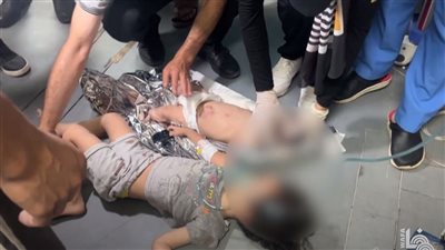 مشاهد لنقل جرحى القصف الإسرائيلي إلى مستشفى دير البلح.. فيديو