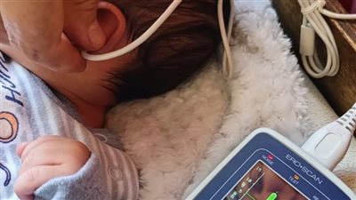 فحص 615 ألف طفل بالشرقية ضمن مبادرة الكشف المبكر عن ضعف وفقدان السمع للأطفال حديثي الولادة