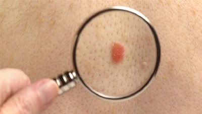 تطوير لقاح جديد 