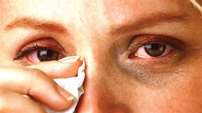 الاكتشاف المبكر يحميك من المياه الزرقاء