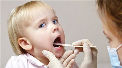 «استشارى» يحذر من مضاعفات اللوزتين عند الأطفال