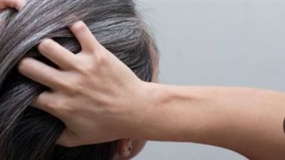 أسباب الشيب المبكر.. تعرف عليها