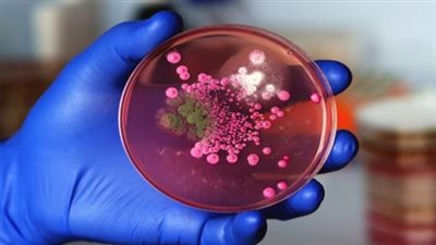 اكتشاف عدوى فطرية جديدة في الصين 