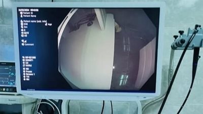  التأمين الصحي بالقليوبية: تشغيل وحدة مناظير الجهاز الهضمي بمستشفى النيل بشبرا 