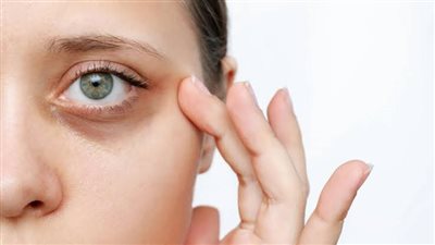 عادات يومية تسبب ظهور الهالات السوداء تحت العينين|كيف تتجنبها للحفاظ على إشراقة بشرتك