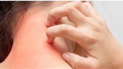 حقيقة إصابتك بالسرطان بهذة الطريقة