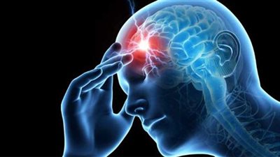 طبيب يكشف أسباب الصداع المستمر في فصل الصيف 