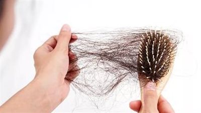 أسباب تساقط الشعر .. تحذيرات مهمة