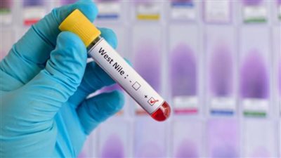 الأردن تسجل أول حالة إصابة بحمى غرب النيل 