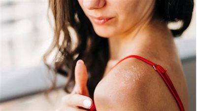 نصائح لاستعادة نضارة البشرة بعد التعرض للشمس