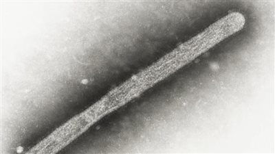 بتكلفة ضخمة .. لقاح إنفلونزا الطيور مجانًا للعمال في أمريكا 