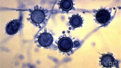 رجل يفقد 22 كجم من وزنه دون أي مجهود لهذا السبب