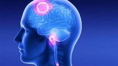 علاج واعد للشكل الأكثر عدوانية من سرطان الدماغ