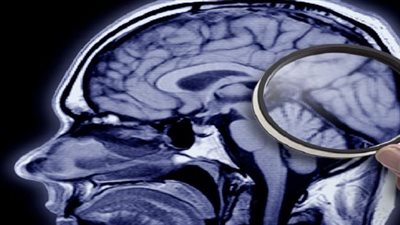 اكتشاف تأثير سحري لـ