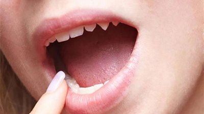 انتبه.. لون فمك المتغير قد يشير إلى تلك الأمراض