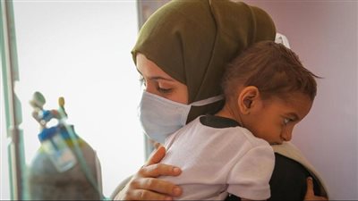 الأمم المتحدة تحذر من تزايد سوء التغذية الحاد بسرعة في مناطق الحكومة اليمنية