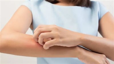 أسباب وعلاج الحكة 