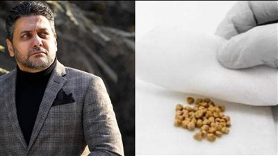 بعد إصابة تامر فرج| أسباب تكوّن حصوات المرارة وكيفية الوقاية منها