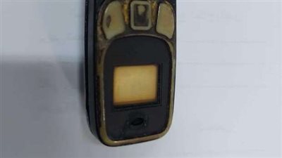 استخراج موبايل من معدة شاب بعد مرور 5 أشهر| شاهد