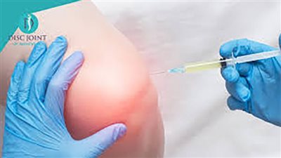 5 تقنيات حديثة للحقن الموضعى تعالج خشونة الركبة