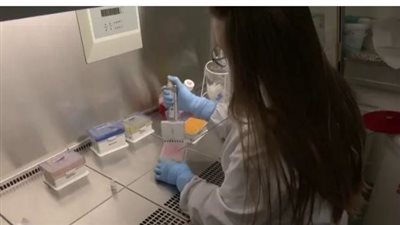 حقيقة احتواء فيروس جدرى القرود 