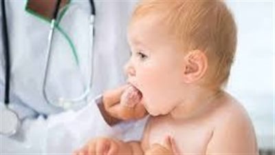 أعراض نقص فيتامين د عند الأطفال 