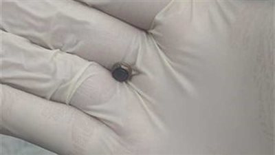 مدير مستشفى العجمى يكشف كواليس انقاذ طفلة من الموت بالإسكندرية