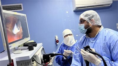 إجراء 10 مناظير مرارية وقولونية بمستشفى بلبيس المركزي 