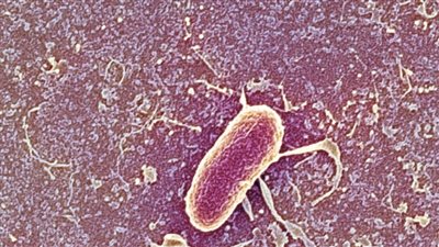 العدوى المقاومة للمضادات تقتل الملايين حول العالم هذا العام