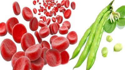 أنيميا الفول.. كيفية الوقاية والأطعمة الممنوعة
